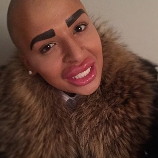 Den brittiska killen Jordan James Parke, 23, har lagt en miljon kronor på kirurgiska ingrepp för att se ut som Kim Kardashian. Han har bland annat kört in en hel del fillers och Botox. Han har även gjort hårborttagning och tatuerat sina ögonbryn. Den brittiska killen Jordan James Parke, 23, har lagt en miljon kronor på kirurgiska ingrepp för att se ut som Kim Kardashian. Han har bland annat kört in en hel del fillers och Botox. Han har även gjort hårborttagning och tatuerat sina ögonbryn.